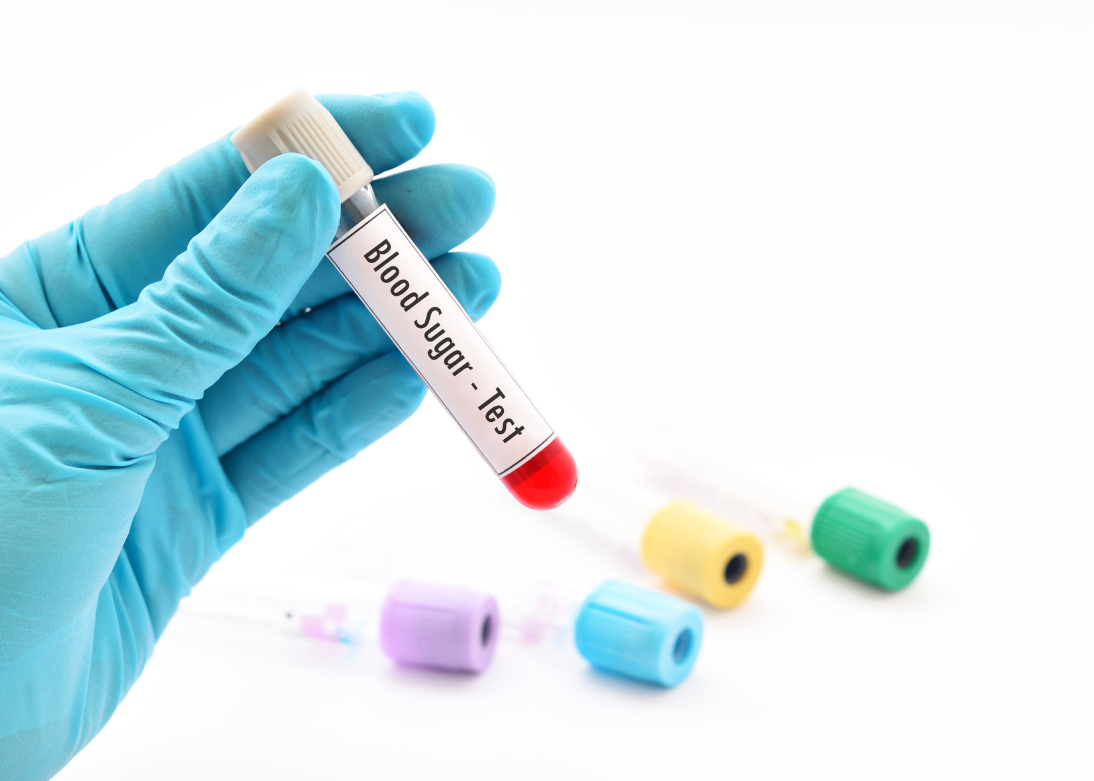 Blood sugar test