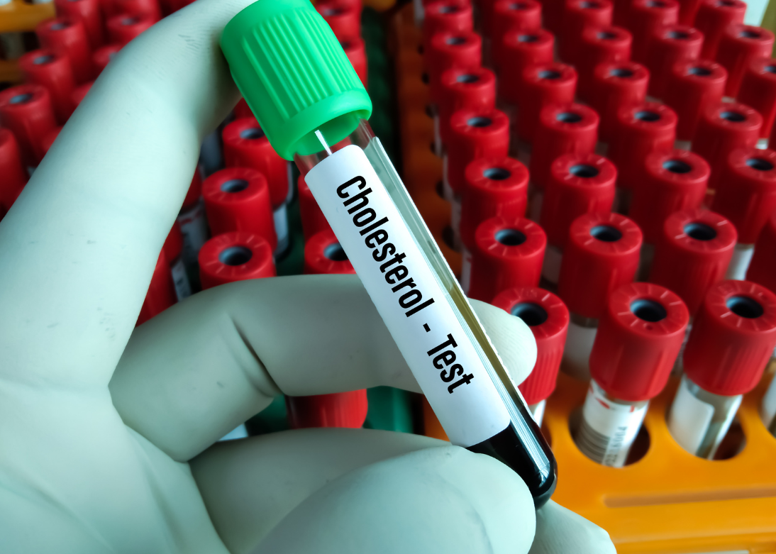 Cholesterol test