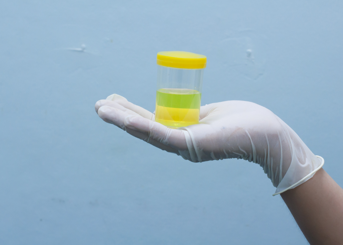 Urine test